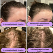 Přírodní olej pro růst vlasů