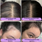 Přírodní olej pro růst vlasů