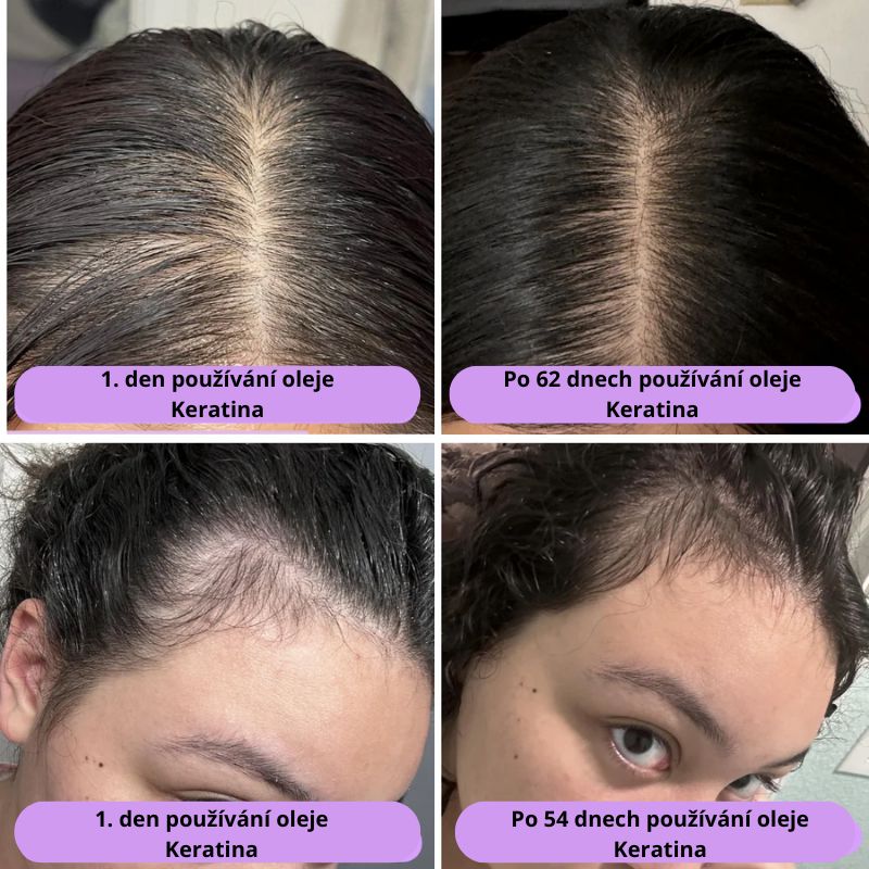 Přírodní olej pro růst vlasů